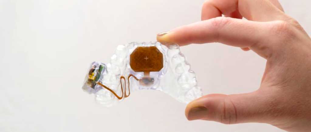 Hand holding a clear mouthguard-like moulding with integrated electronics.